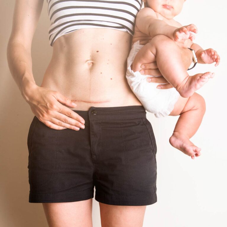 How to Love a Body You Hate: 5 Tips for Moms